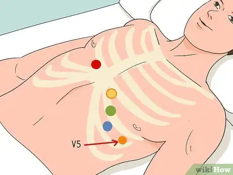 Image titled Put ECG Leads on a Chest Step 10