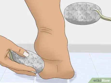 Image titled Wear Toe Rings Step 11