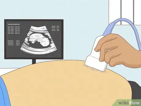 Image titled Tell if a Baby Is a Boy or Girl by the Heartbeat Step 7