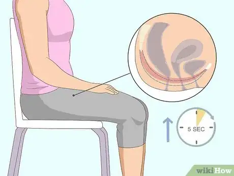 Image titled Do Kegel Exercises Step 7