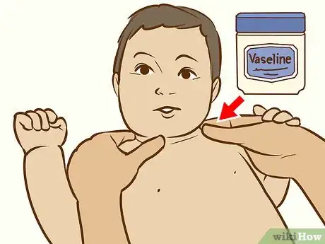 Image titled Treat Neck Rashes for Your Baby Step 2