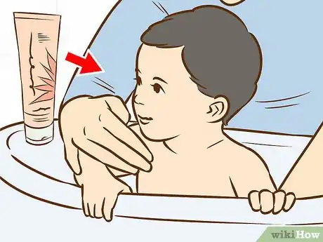 Image titled Treat Neck Rashes for Your Baby Step 1