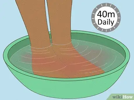 Image titled Use Foot Baths for Athlete’s Foot Step 15