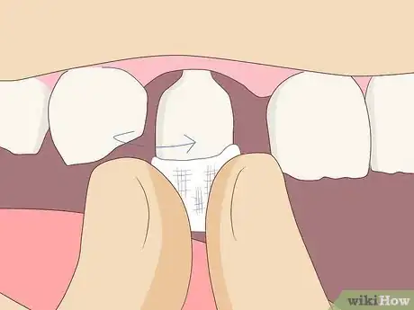 Image titled Pull Out a Tooth Without Pain Step 6