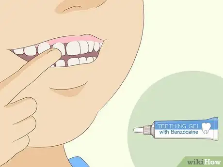 Image titled Pull Out a Tooth Without Pain Step 5