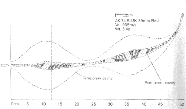 AK-74 5.45x39mm wound ballistics