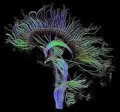 Magnetic resonance imaging