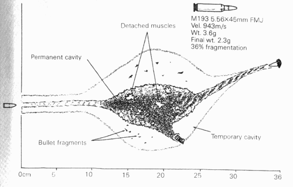 M16 M193 5.56x45mm wound ballistics