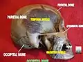 Occipital bone