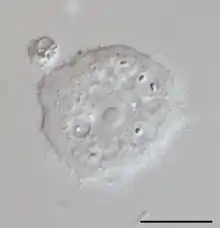 Acanthamoeba sp. (Discosea)