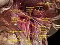 Muscles, arteries and nerves of neck. Newborn dissection.