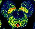 Enhanced Neuromelanin MRI with Color images (RGB) showing Substantia nigra pars compacta